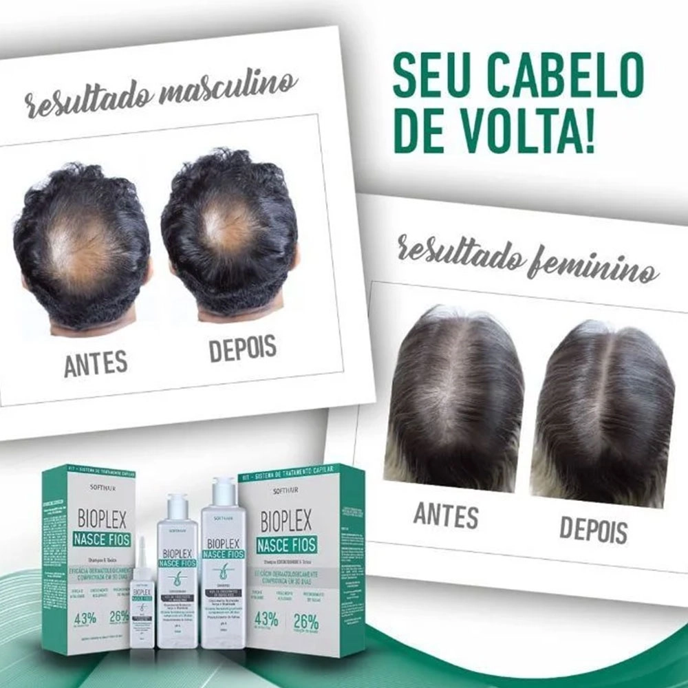 KIT BIOPLEX SHAMPOO CONDICIONADOR E TÔNICO CAPILAR NASCE FIOS SOFT HAIR 